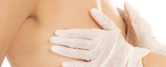 Accessory Nipple Correction at MACS Clinic